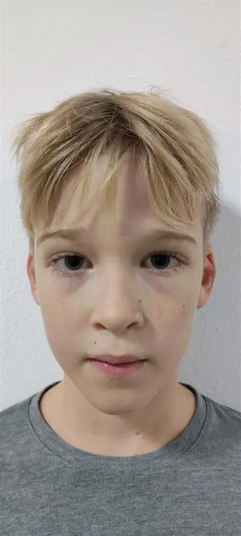 Louis ŠIMONOVIČ