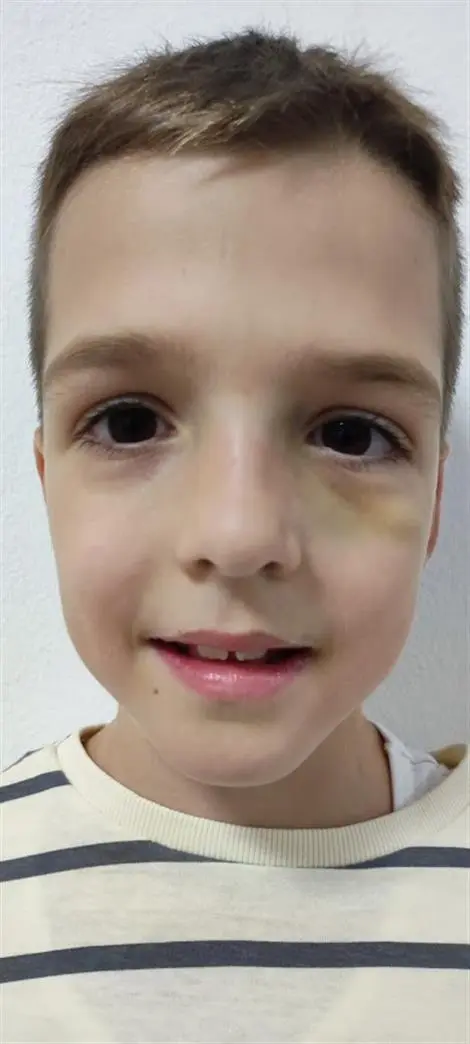 Matej PEŠKO