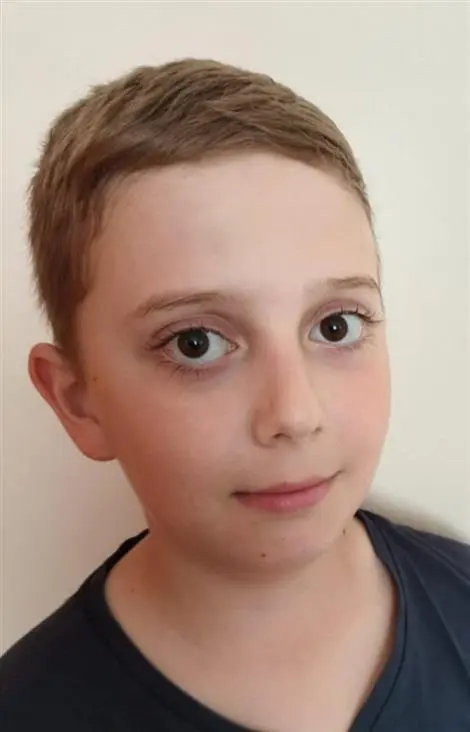 Timotej GALLY