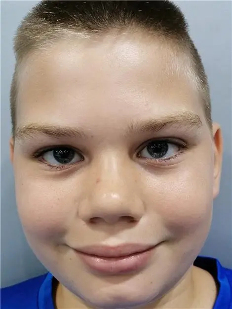 Adam NÉMETH