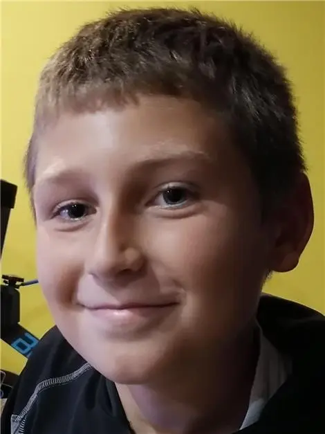 FT