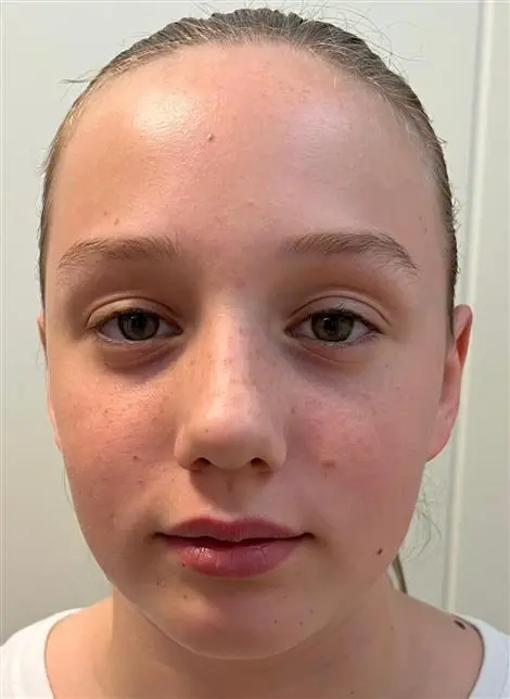 HF